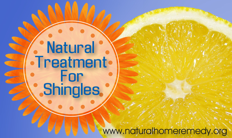 Natural Remedy For Shingles