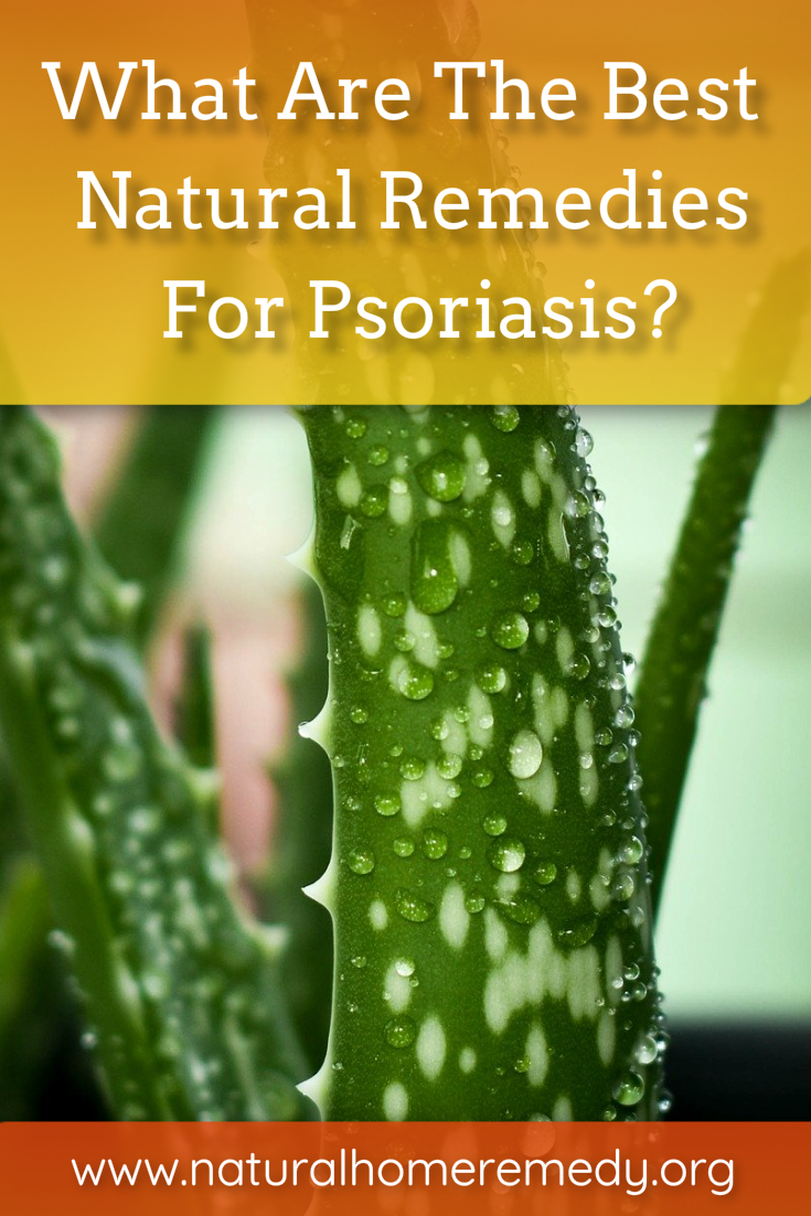 natural remedies for psoriasis