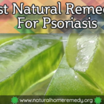 natural treatment for psoriasis