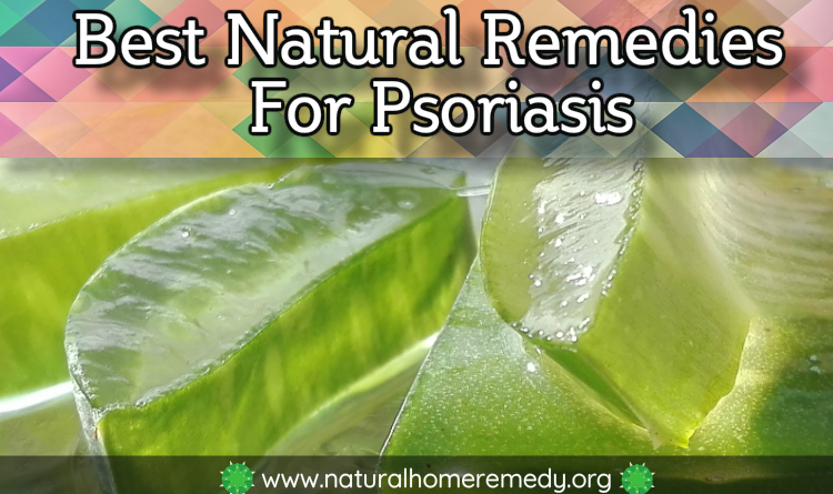 natural treatment for psoriasis