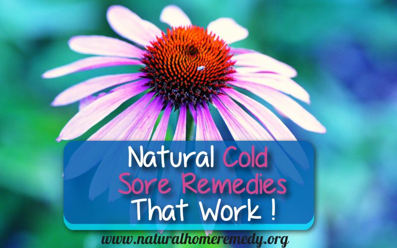 Natural Cold Sore Remedies That Work