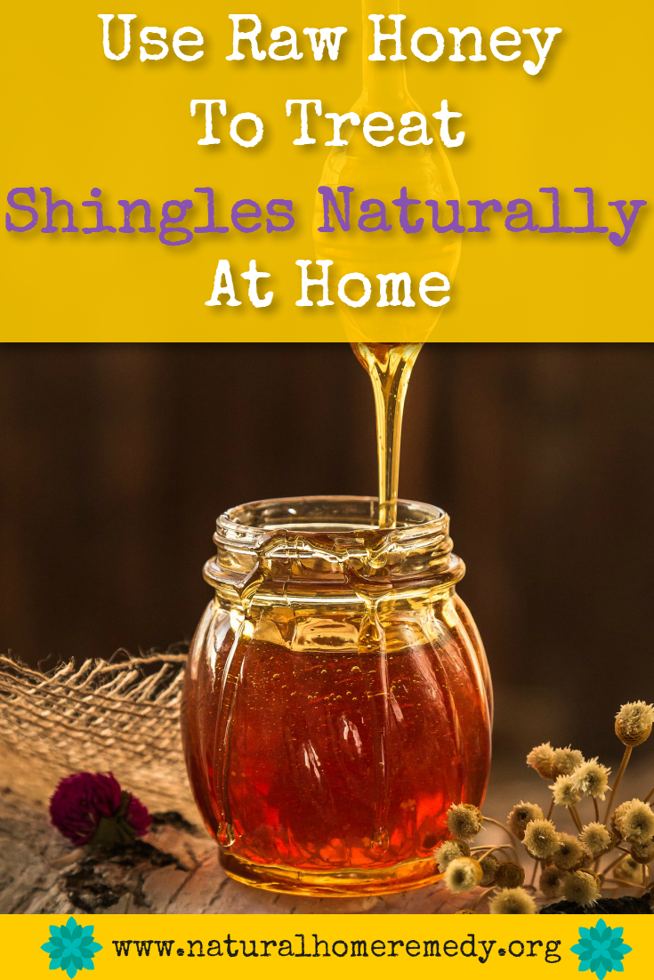 Home Treatment For Shingles