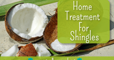 Treatment For Shingles At Home