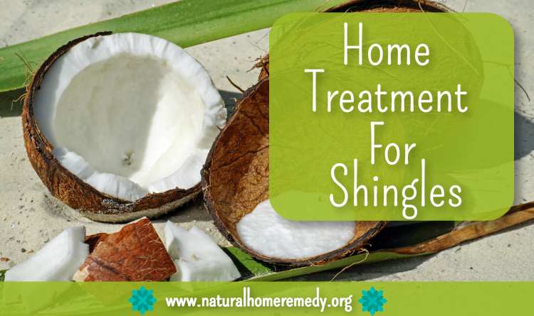 Treatment For Shingles At Home
