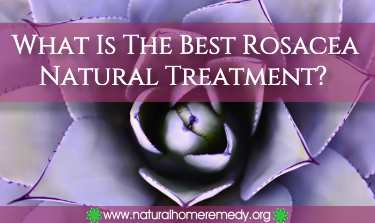rosacea natural treatment