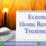 eczema home remedies