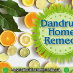 dandruff home remedies