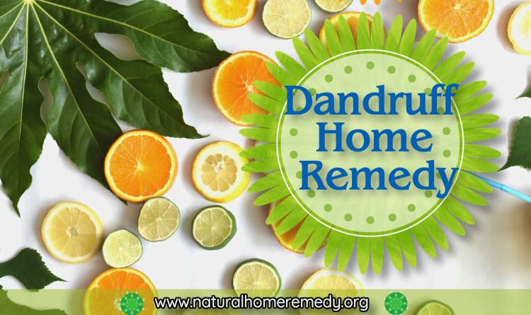 dandruff home remedies