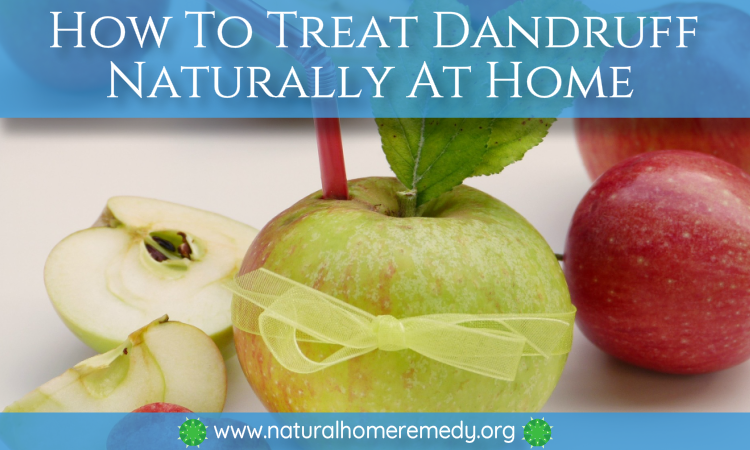 dandruff home remedy